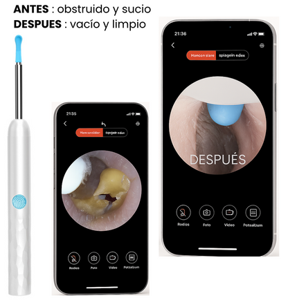 Limpiador de oídos con camara